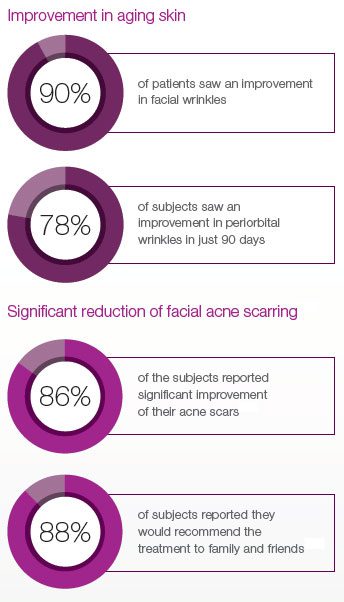 Exceed Microneedling Satisfaction