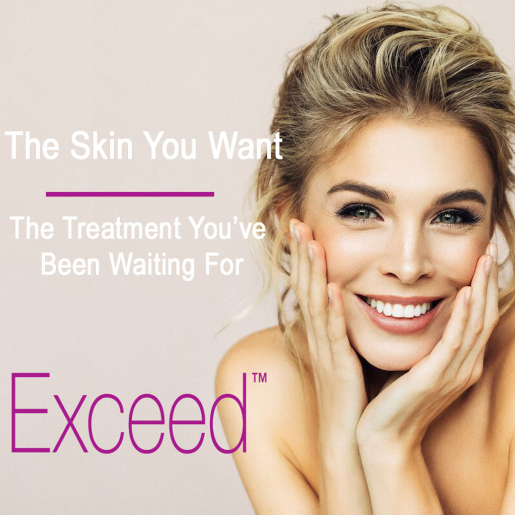 Exceed Microneedling at Rejuvience Med Spa