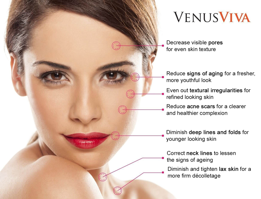 Venus Viva Phoenix Skin Resurfacing Benefits