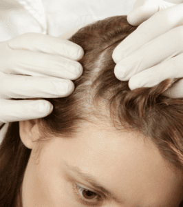 Thinning Hair Needing Treatment Scottsdale Phoenix