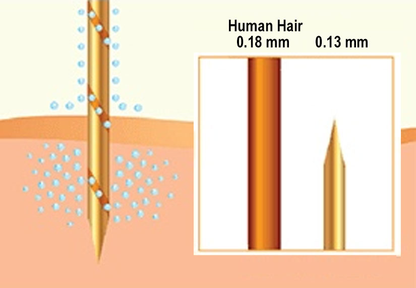 A needle is shown piercing skin with an inset comparing its tip diameter (0.13 mm) to a human hair (0.18 mm). Blue dots surround the needle.