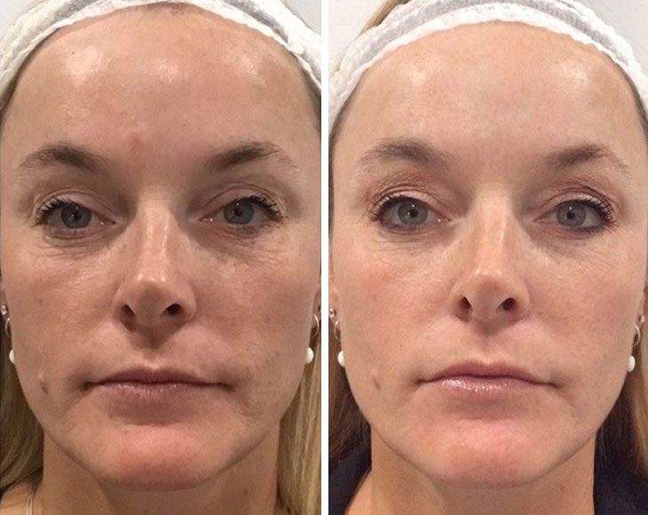 Before and after images of a