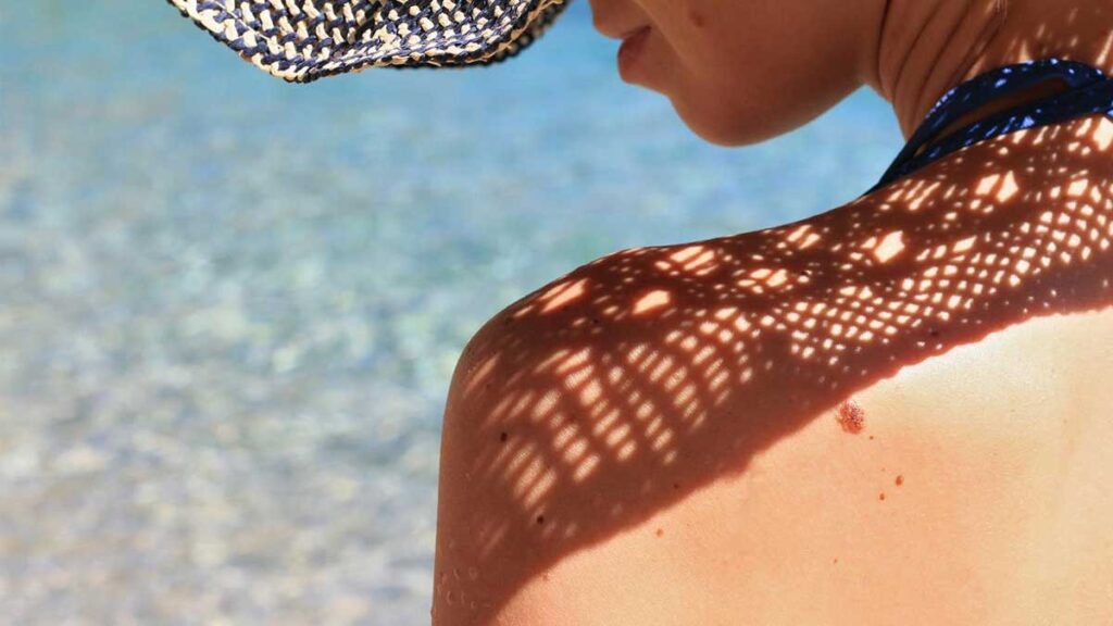 An image of a woman with the sun creating a tan pattern on her shoulder