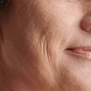 An image of a woman's face with fine lines