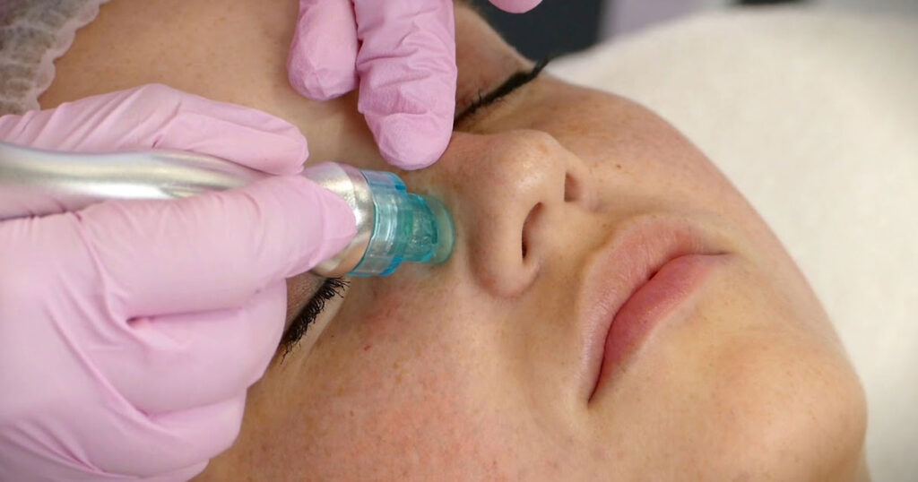 An image of a client receiving a Hydrodermabrasion Facial at Rejuvience Med Spa in Scottsdale