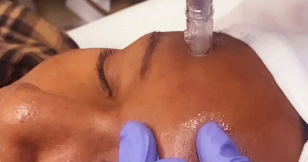 An image of a client receiving a Nano Infusion Facial at Rejuvience Med Spa Scottsdale